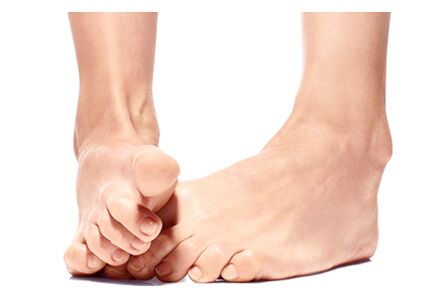 Foot Trooper - a natural remedy for foot and nail fungus